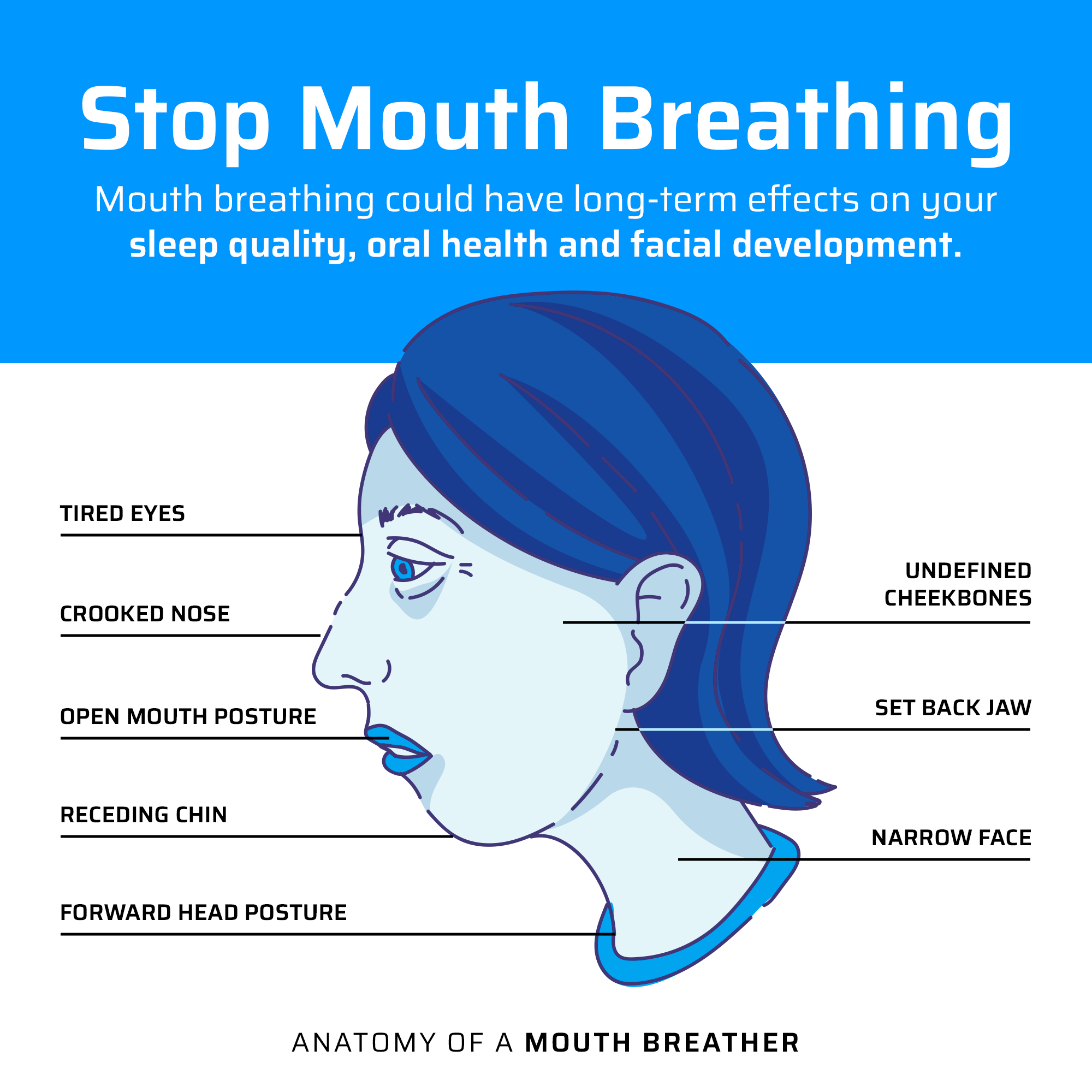 Nasalite Mouth Tape - Stop Mouth Breathing Today